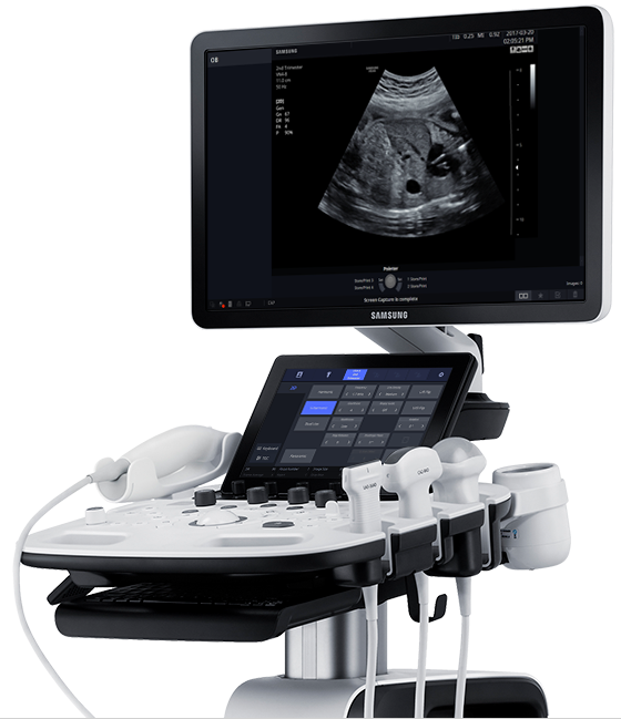 Samsung HS40 ultrasound system