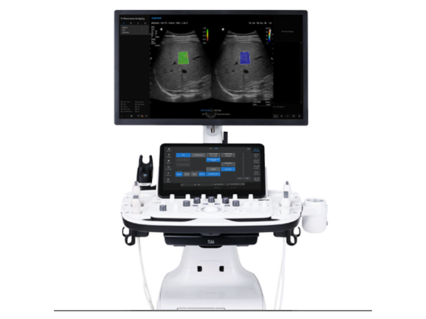 Samsung V8 ultrasound system